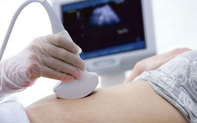 PROBING: Pregnant women’s data are valuable to advertisers as they make big purchases.   Picture: THINKSTOCK